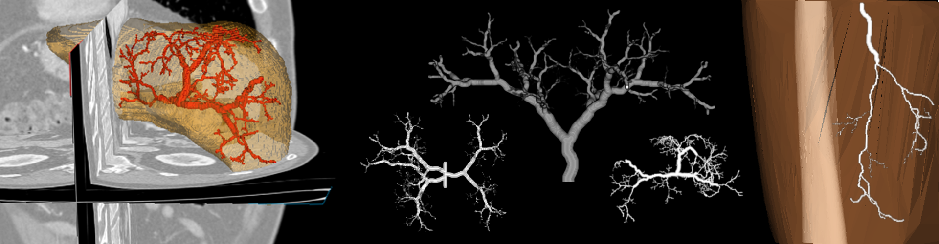 Three-dimensional synthetic blood vessels generation using stochastic Lindenmayer systems